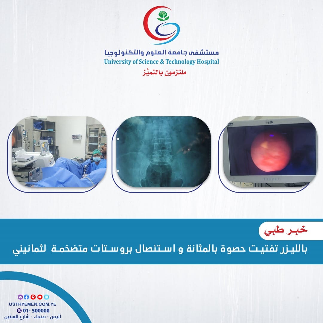 بواسطة جهاز الليزر والمنظار المرن..
